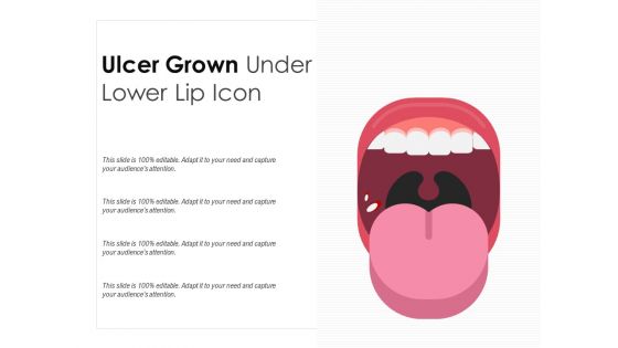 Ulcer grown under lower lip icon